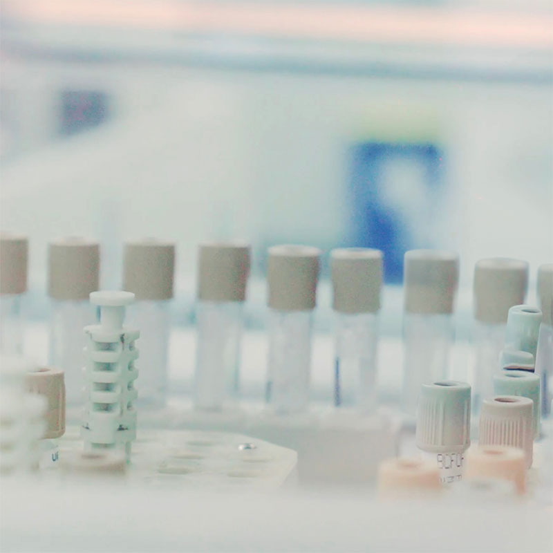 Labs